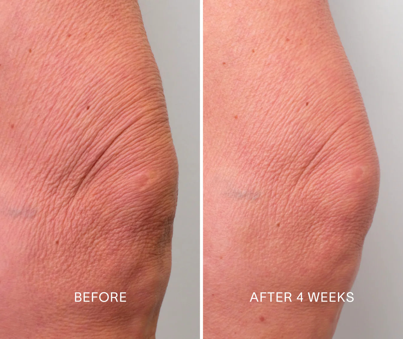 DR Body Repair Treatment