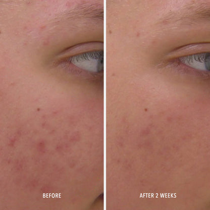 HP Clear Rescue Serum