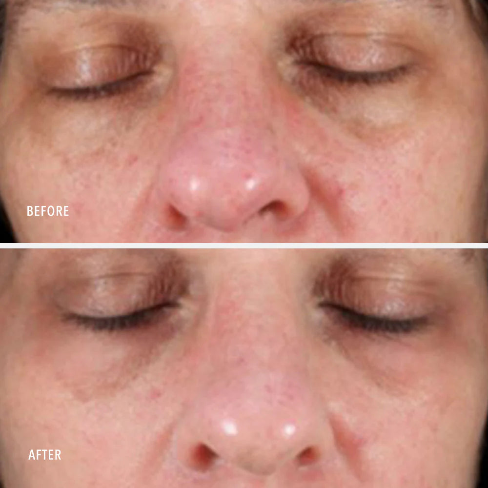 HP Collagen ReActivate PM