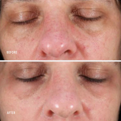 HP Collagen ReActivate PM